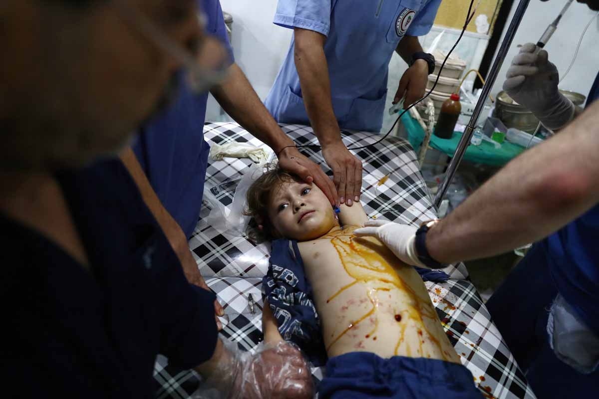 An injured Syrian child receives treatment at a makeshift hospital following a reported air stike on the rebel-held town of Douma, east of the capital Damascus, on August 21, 2016. 